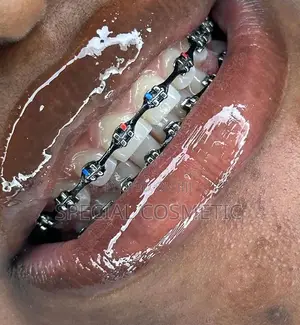 Fashion Braces