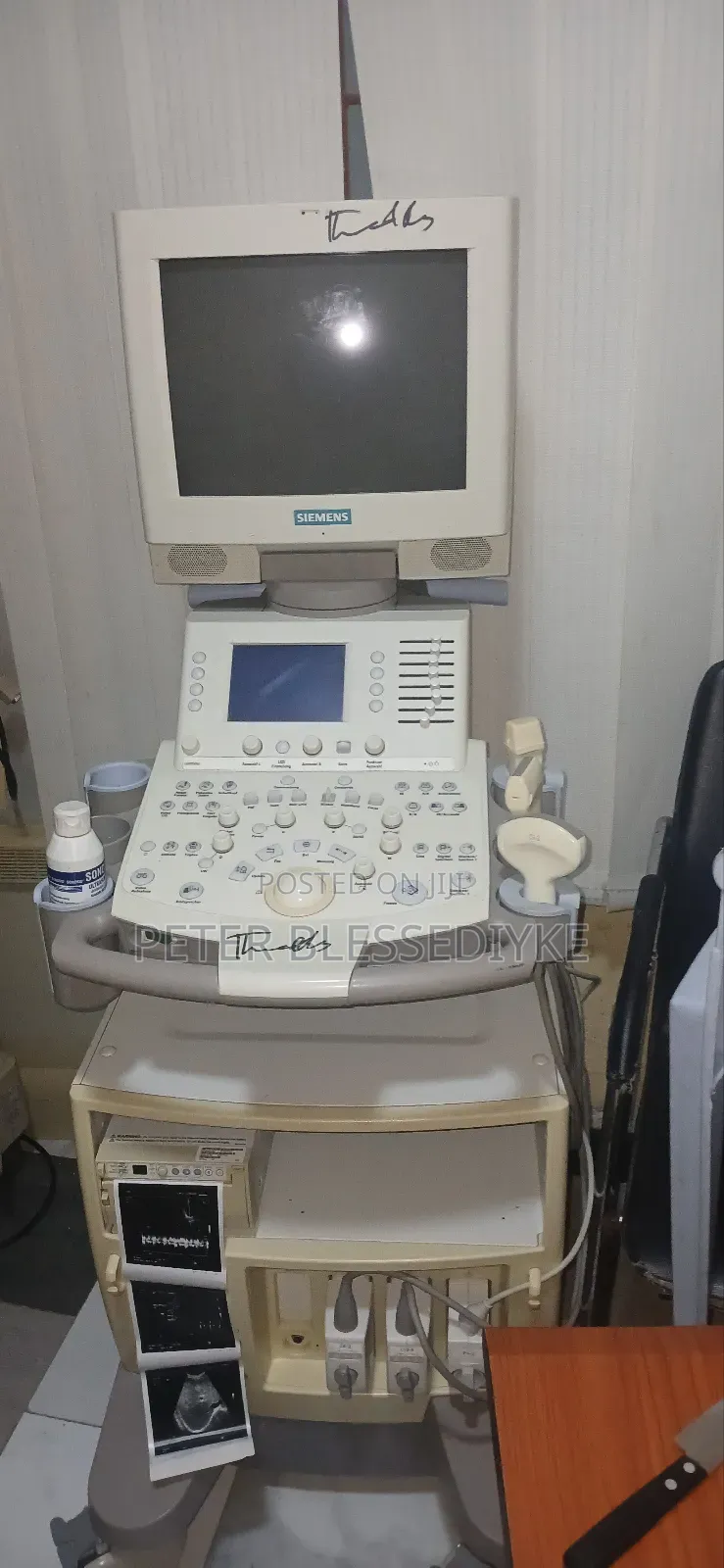 Siemens Sonoline G60s