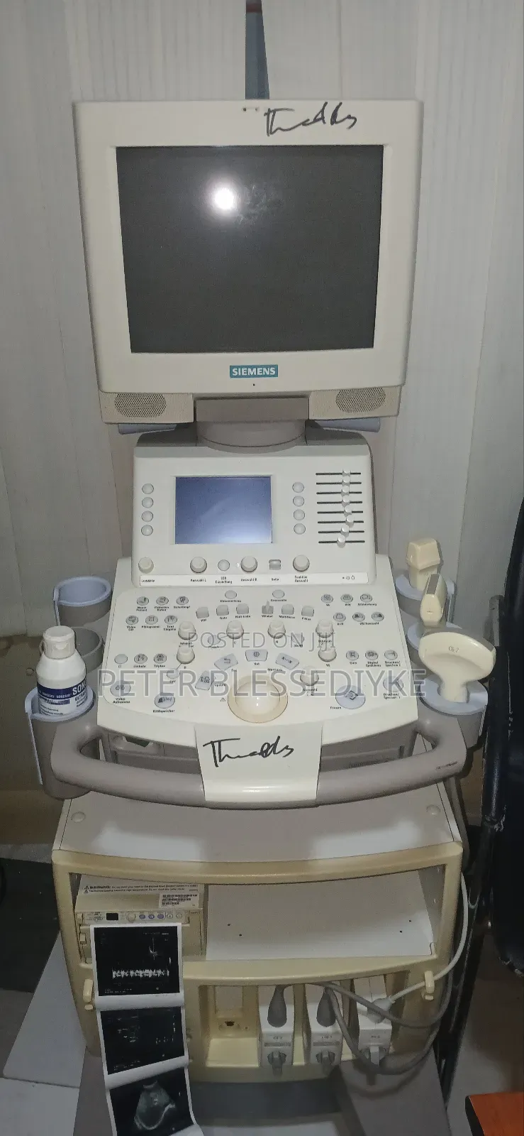 Siemens Sonoline G60s