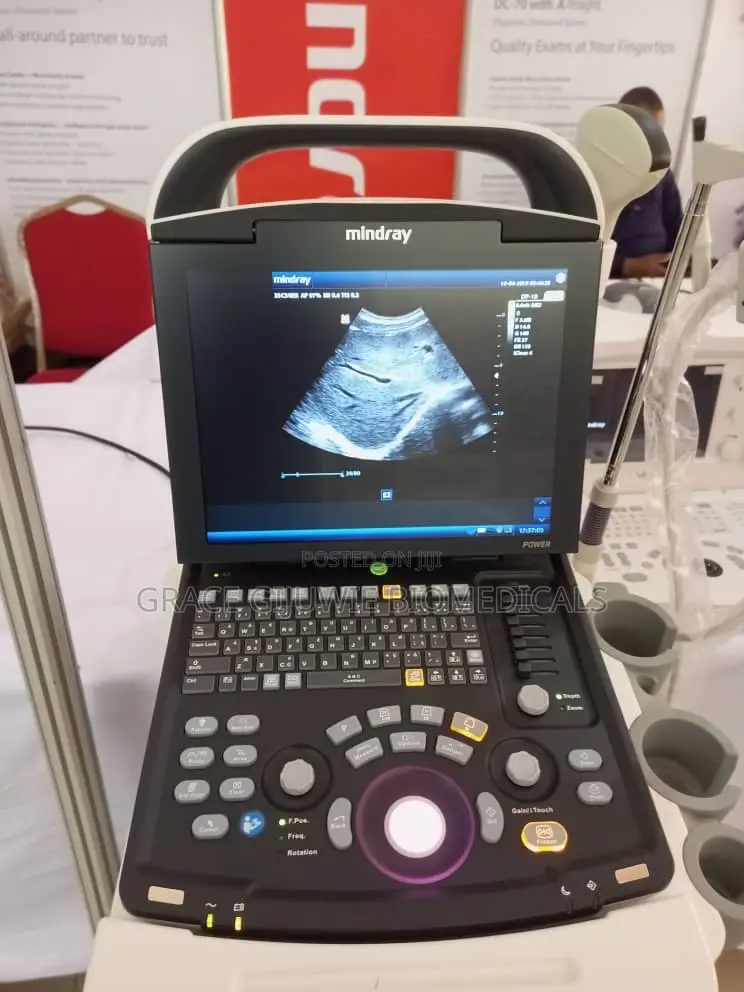 Mindray Dp10 Ultrasound