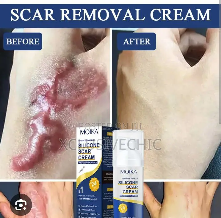 Moika Silicone Scar Cream