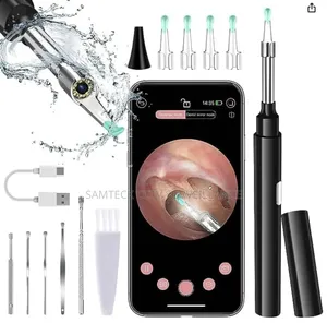 Ear Wax Removal With Camera