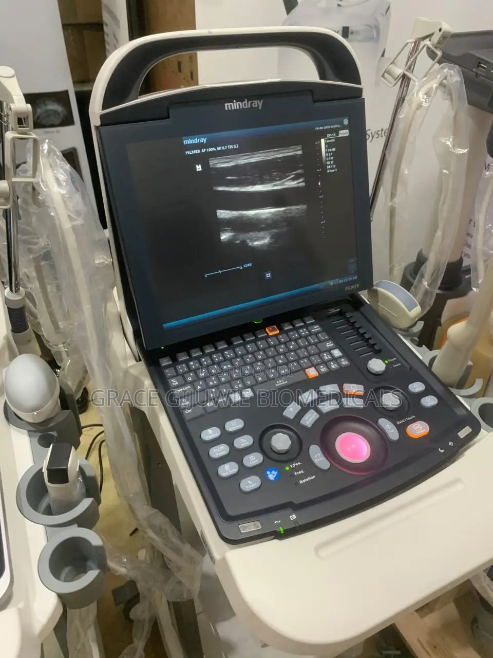 Mindray Dp10