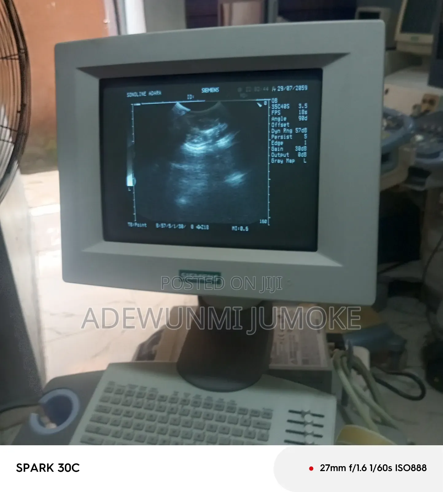 Sono Line Adara Ultrasound