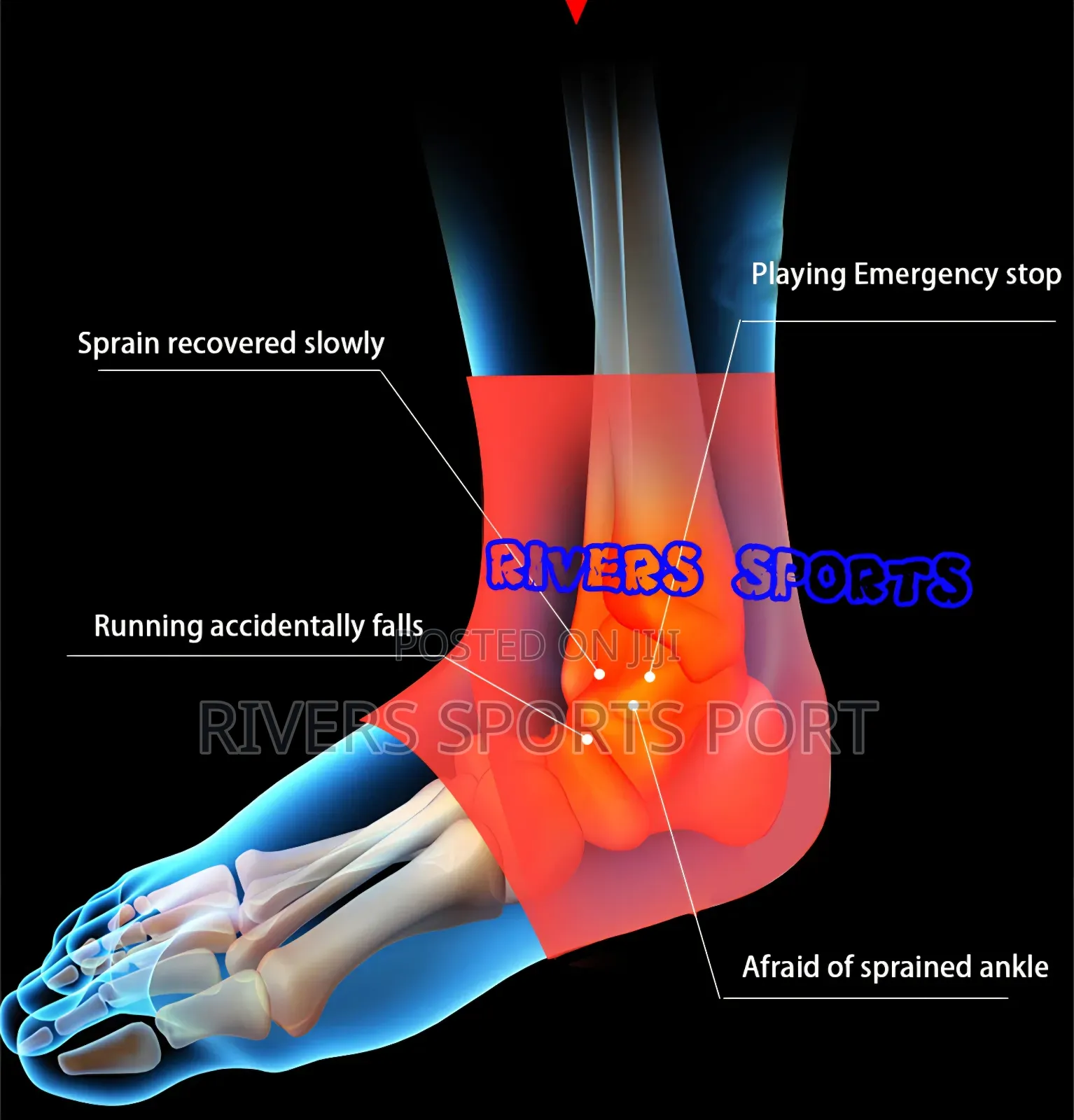 1pc Ankle Brace Pressurized Bandage Ankle Support Compression Strap