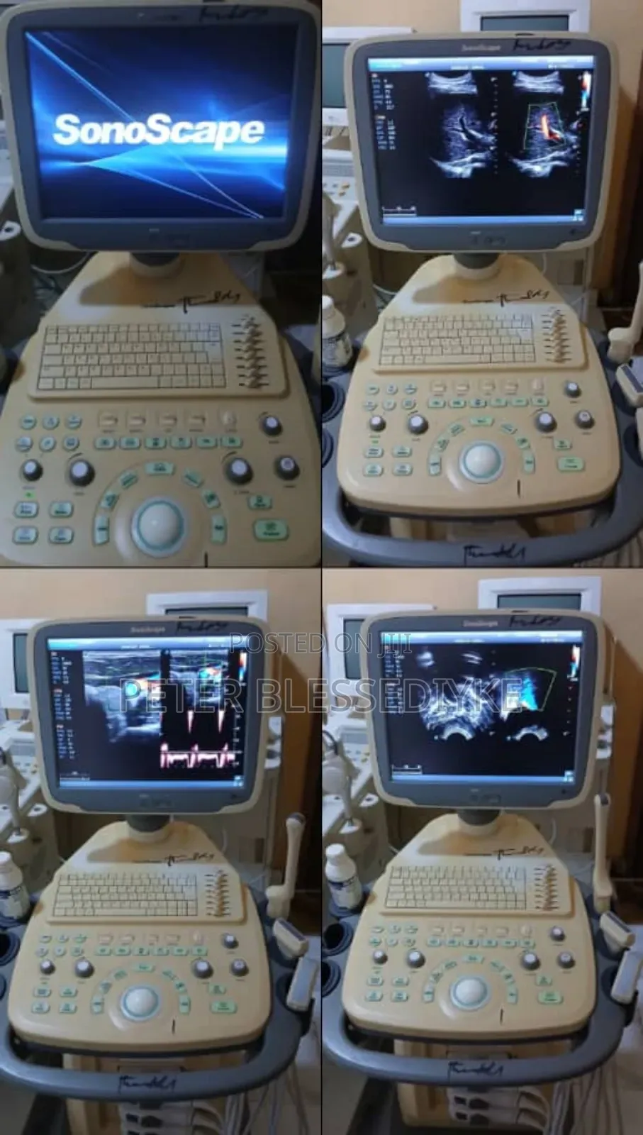 Sonoscape S11