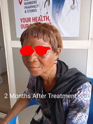 Skincare Consultation Services