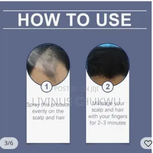 Effective Hair Growth With 6% Minoxidil for Both Men and Women