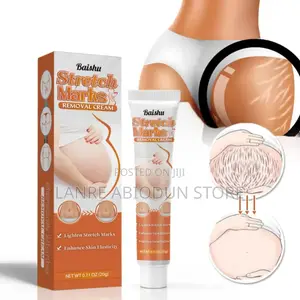 Stretch Marks Removal