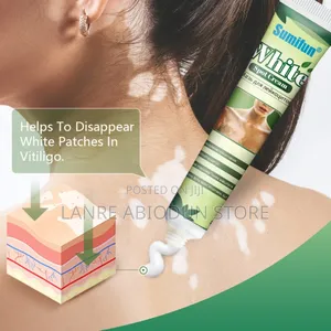 Vitiligo Care Cream