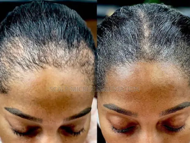 IS Beauty Afro Grow Black Soap Result 5