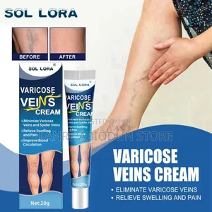 Vericose Veins Cream
