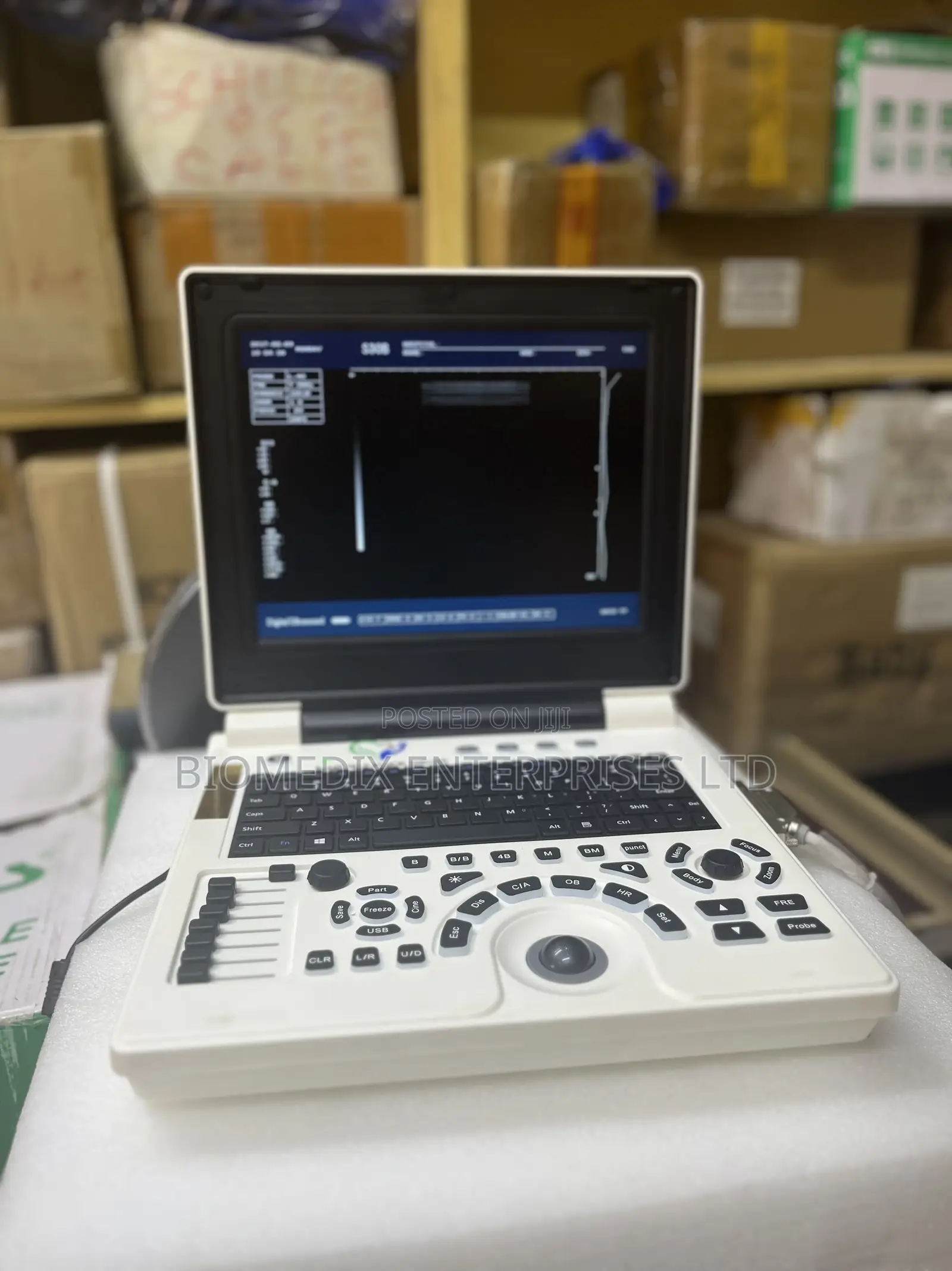 Laptop Utrasound Machine
