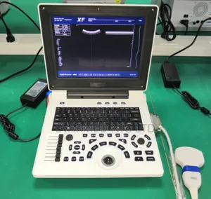 Laptop Ultrasound Machine