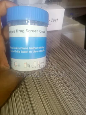 Udt Test Kits
