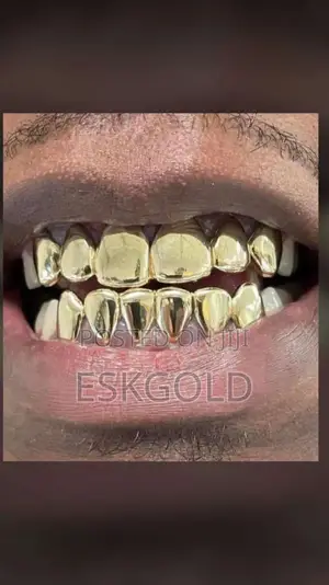 Gold Teeth