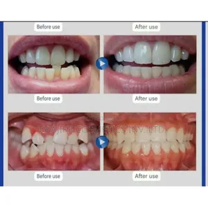 3 Stages Orthodontic Teeth Retainer