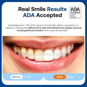 Usa Bitvae D2 Ultrasonic Electric Toothbrush