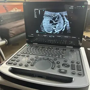 Mindray Mx3 Ultrasound Machine
