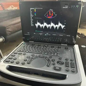 Mindray Mx3 Ultrasound Machine