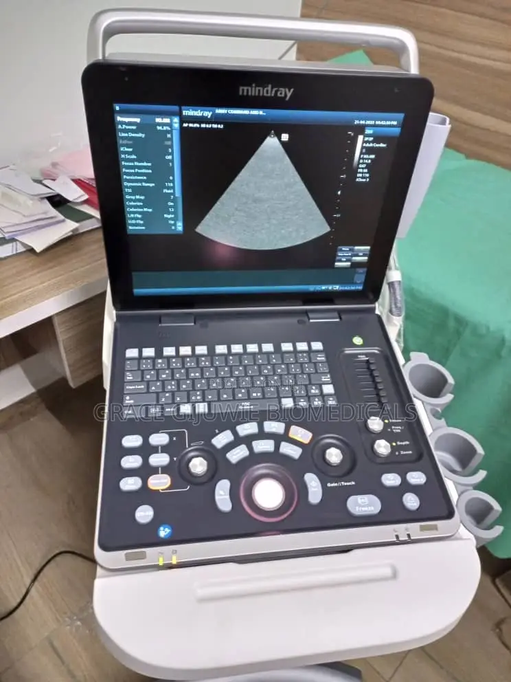 Mindray Z50 3d Ultrasound Machine