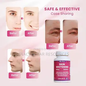 Original Skin Brightening Glow Tablets Available for Sale