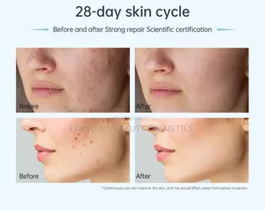 Dr. Pen A11 Ultima Pro Microneedling Pen
