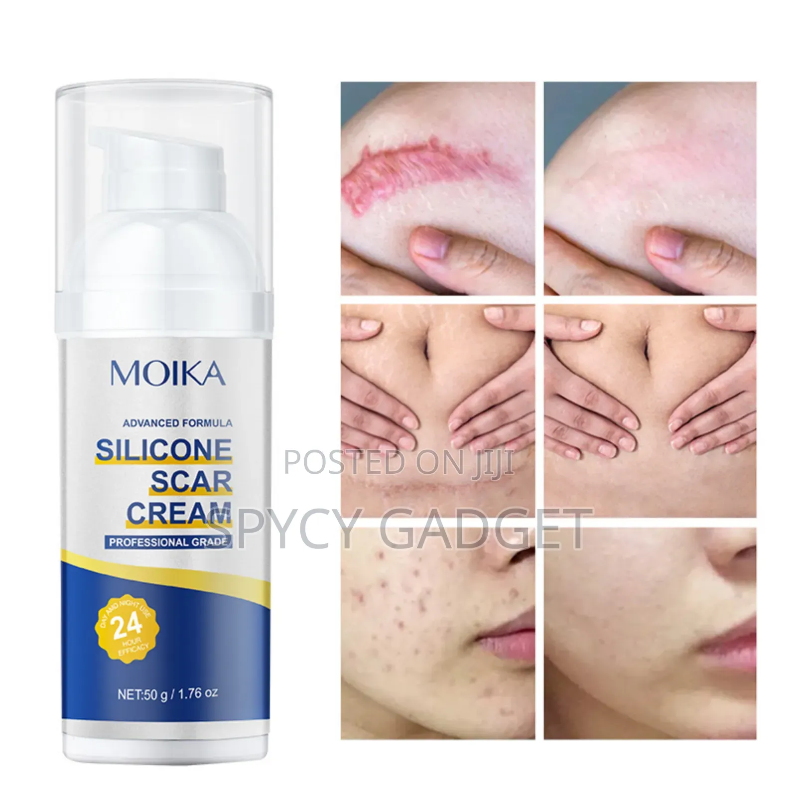 Advanced Silicone Scar Removal Gel Cream