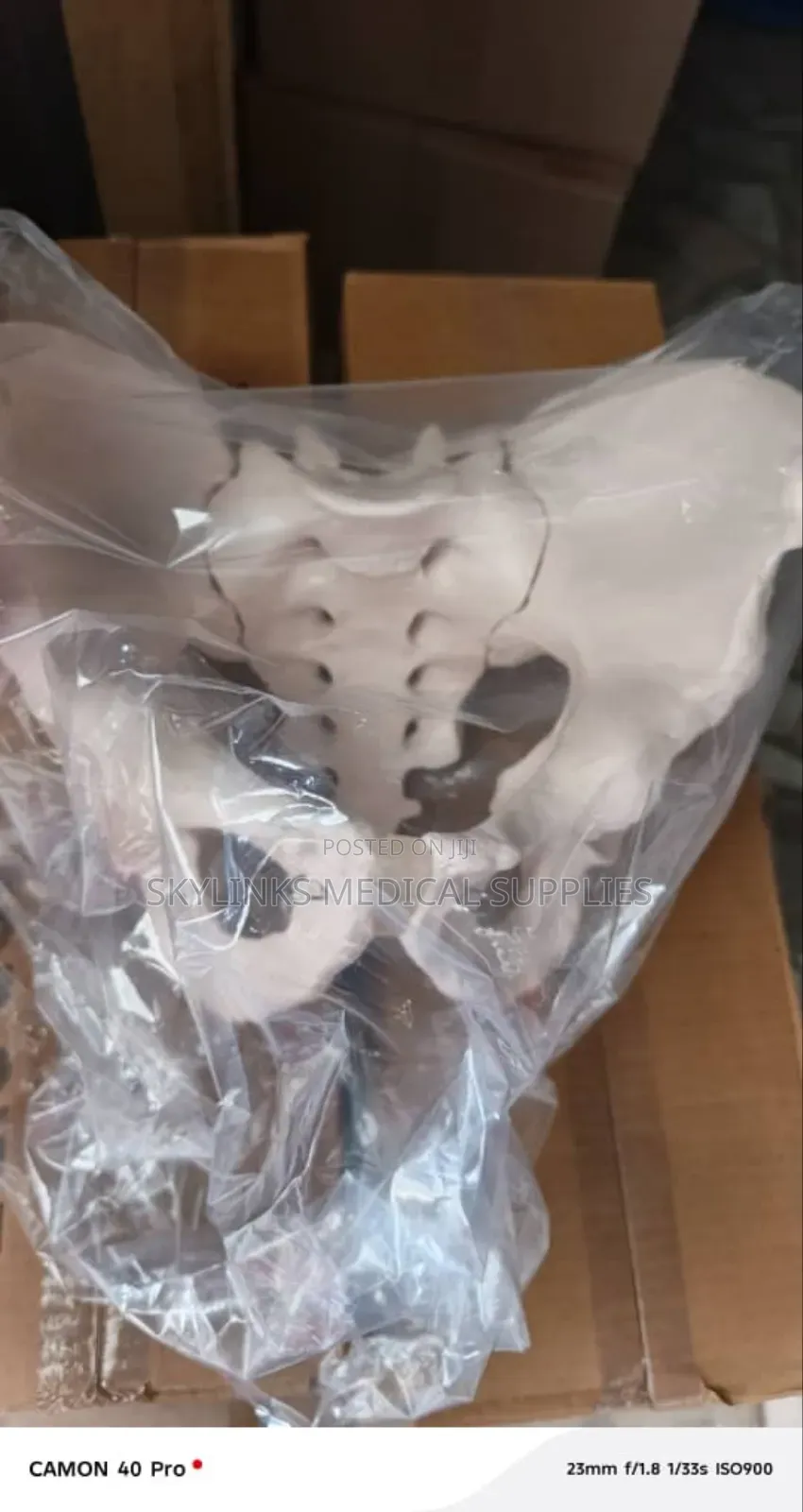 Pelvic Bone Model