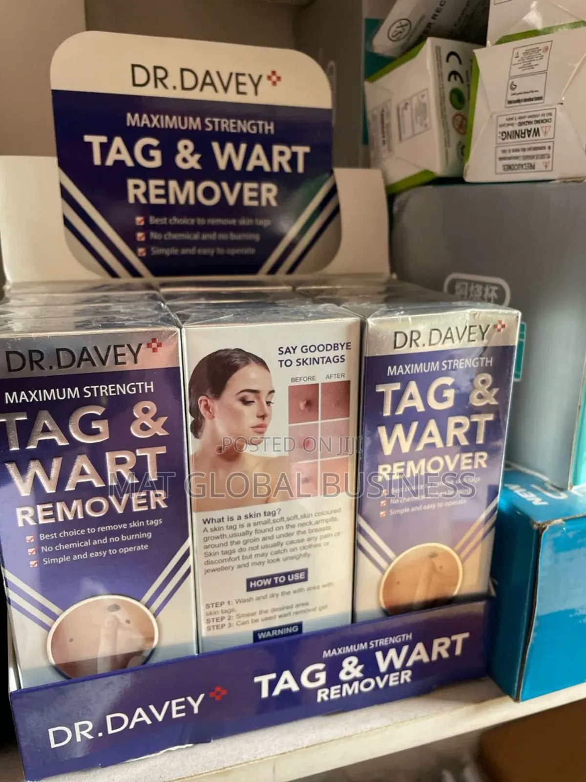 Tag and Wart Removal