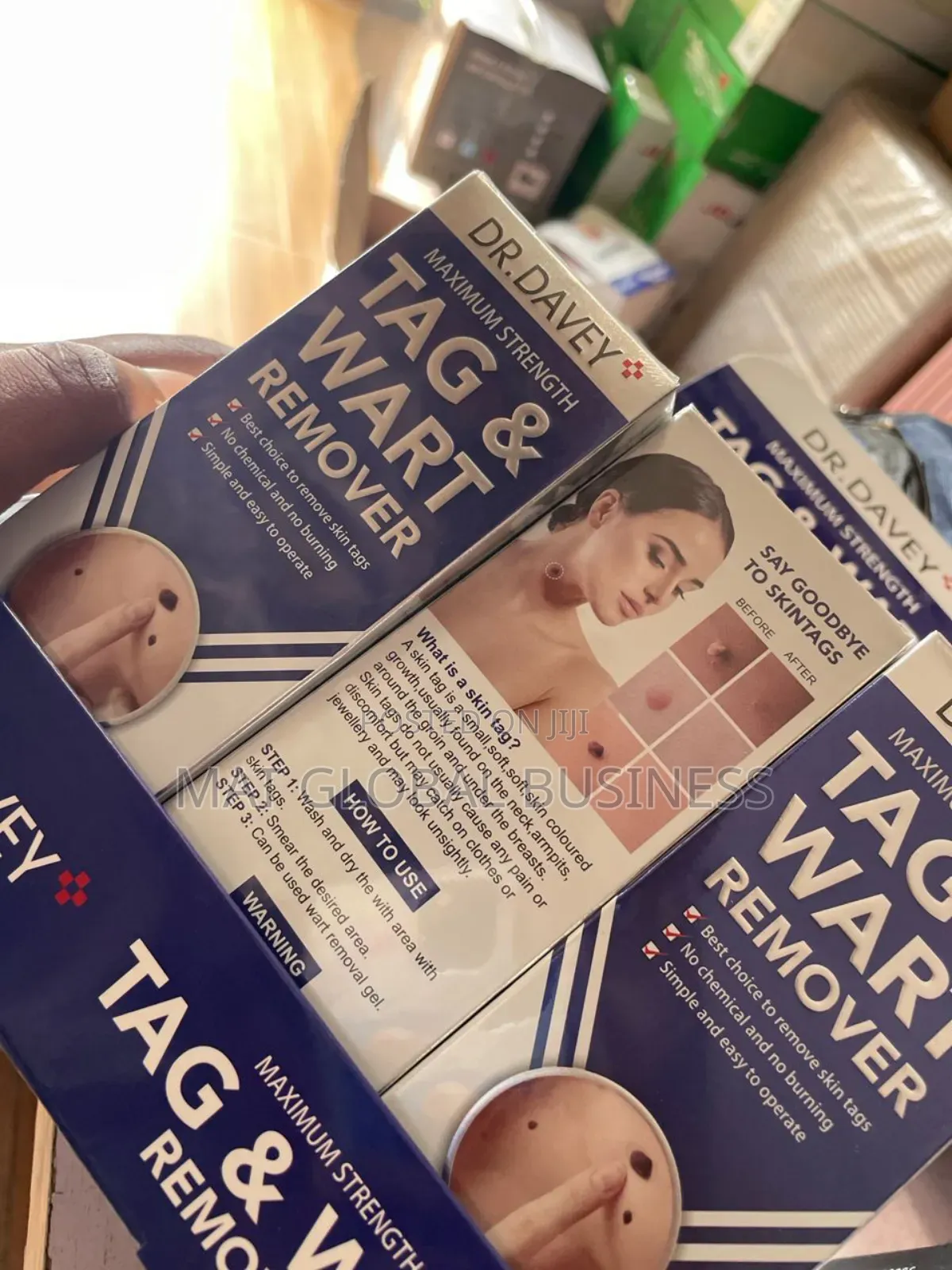 Tag and Wart Removal