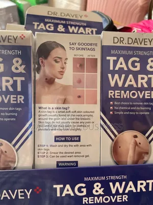 Tag and Wart Removal