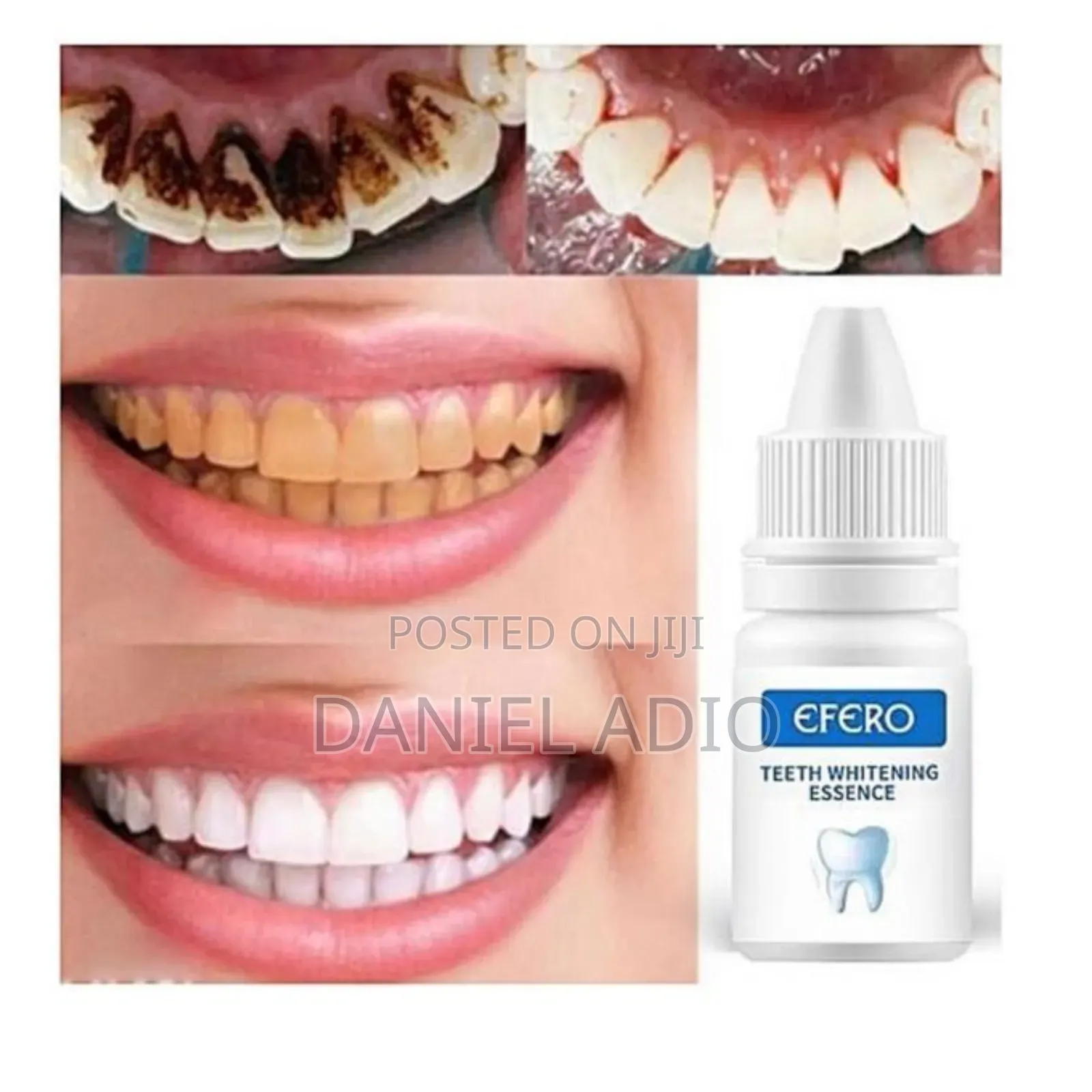 Efero Teeth Whitening