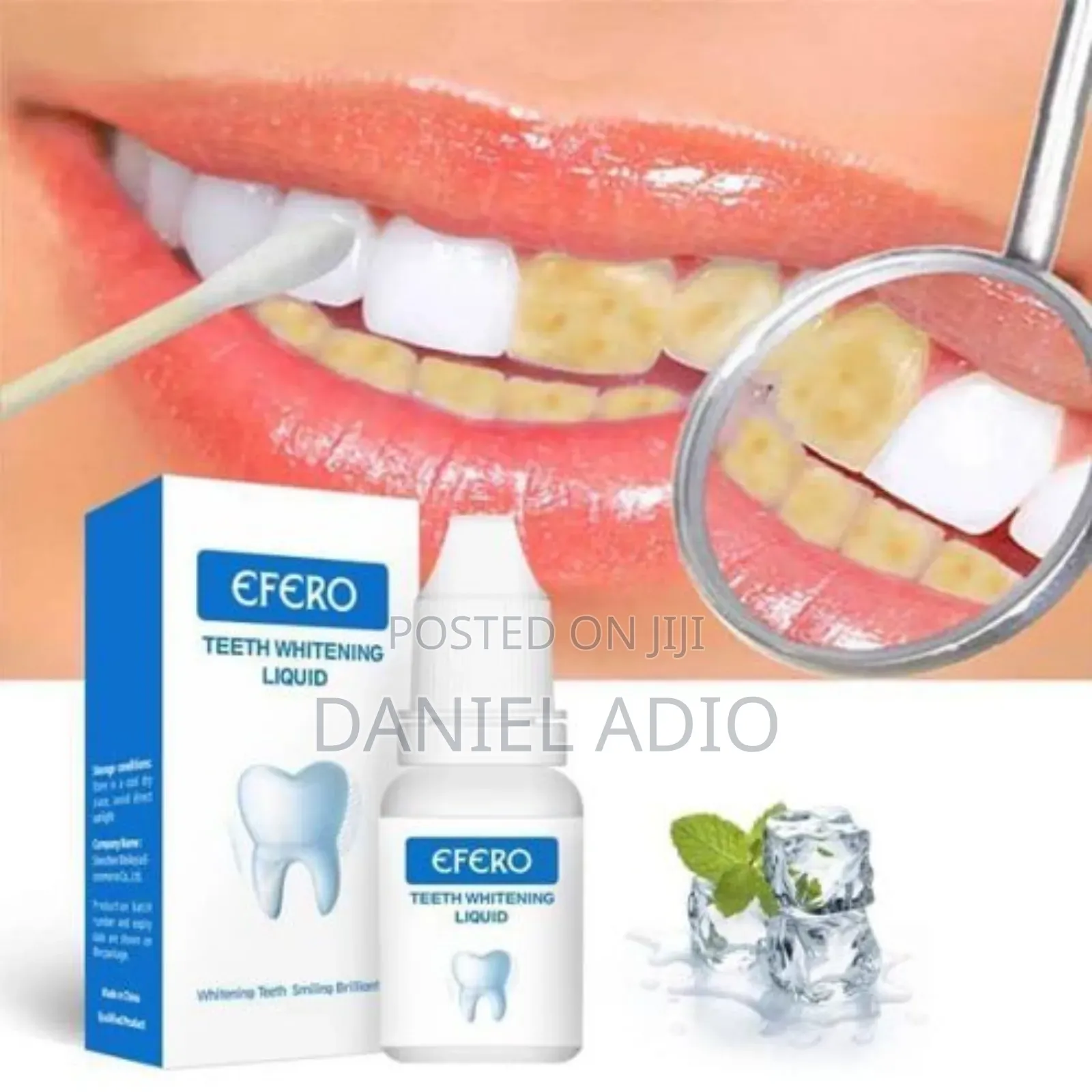 Efero Teeth Whitening