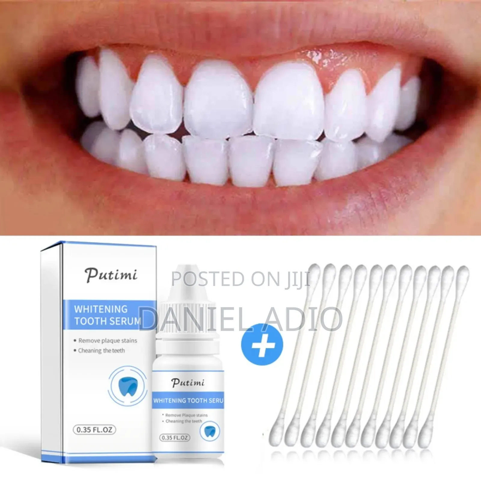 Efero Teeth Whitening