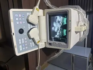 Chison 600m Table Top Ultrasound Machine
