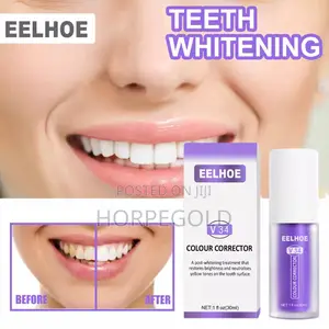 V34 Colour Corrector Teeth Whitening