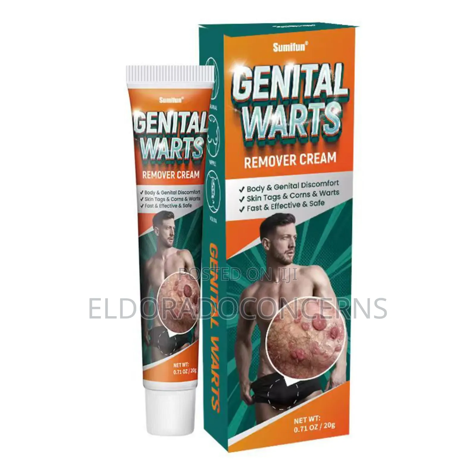 Sumifun Genital Warts