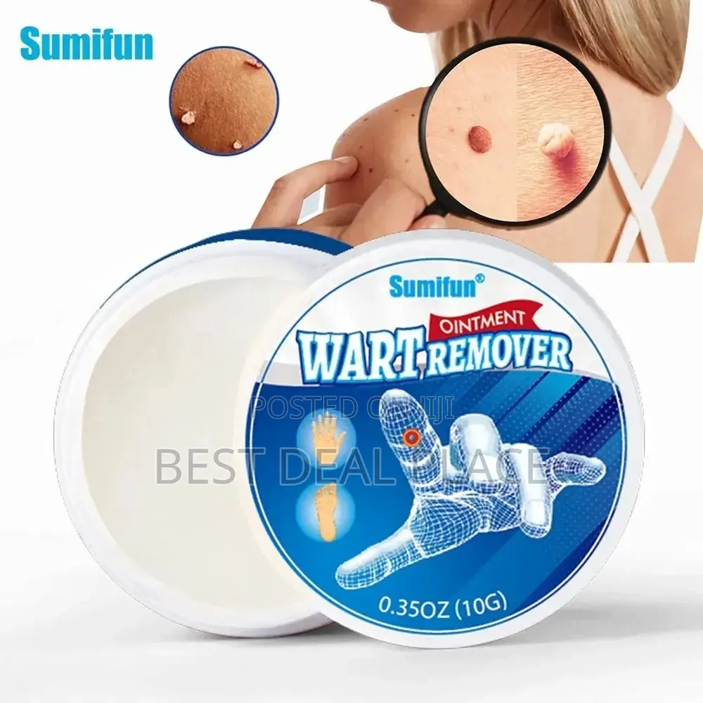 Wart Removal Ointment
