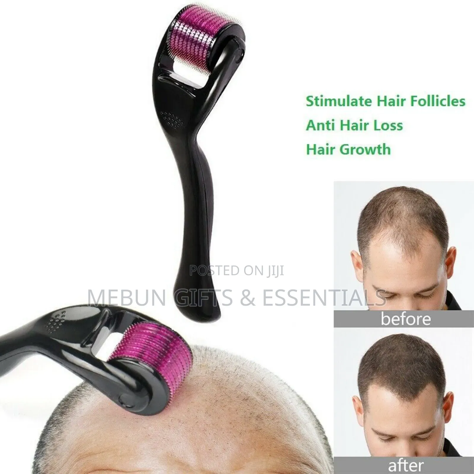 Derma Roller