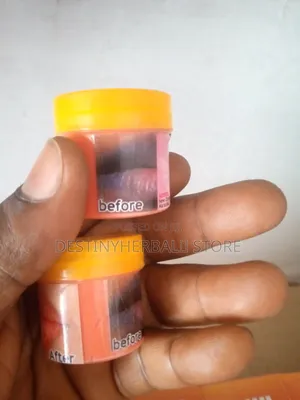 Original Pink Lips Balm for Men and Women