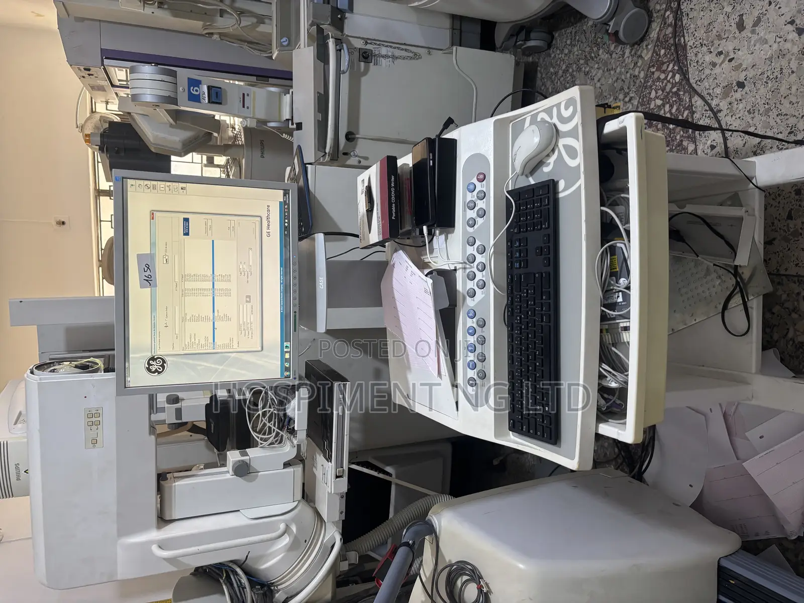 Stress Ecg Treadmill