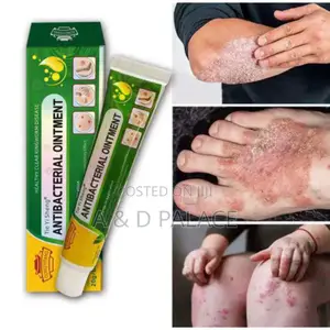 Sumifun Anti-itch Eczema Cream (20g)