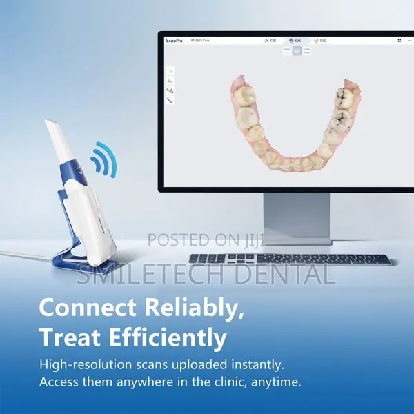 Alliedstar as 200e Intraoral Scanner