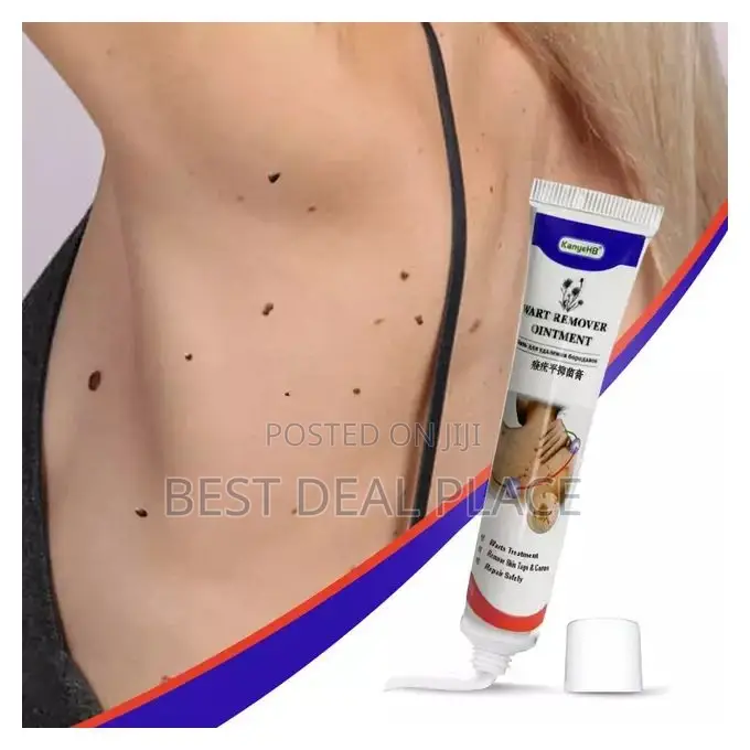 Kanyehb Wart Removal Herbal Ointment Cream