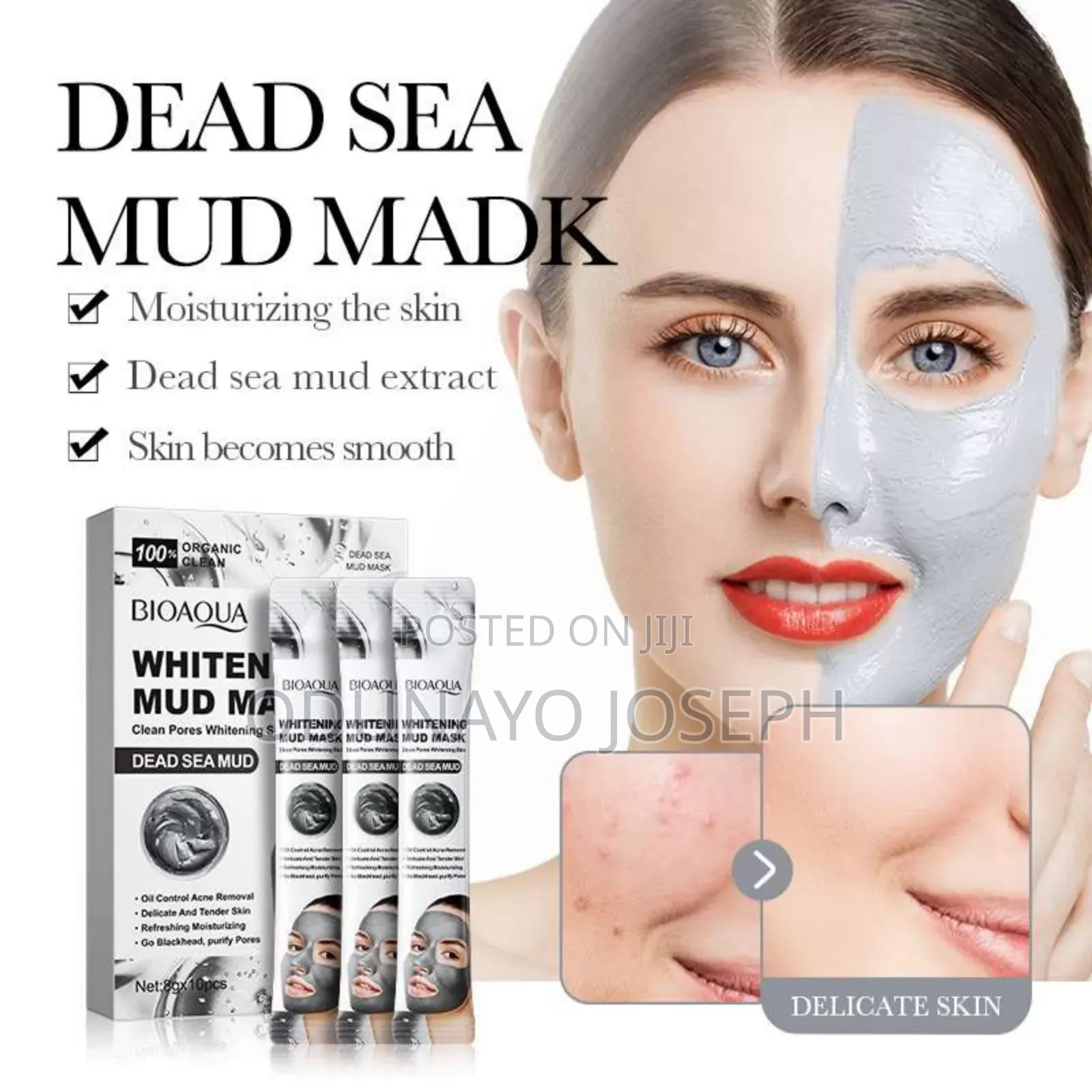 Acne Removal Mud Mask