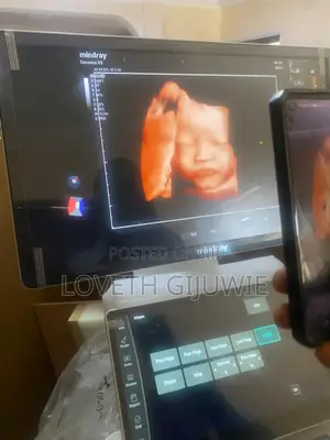 Mindray Consona N5 Ultrasound Machine