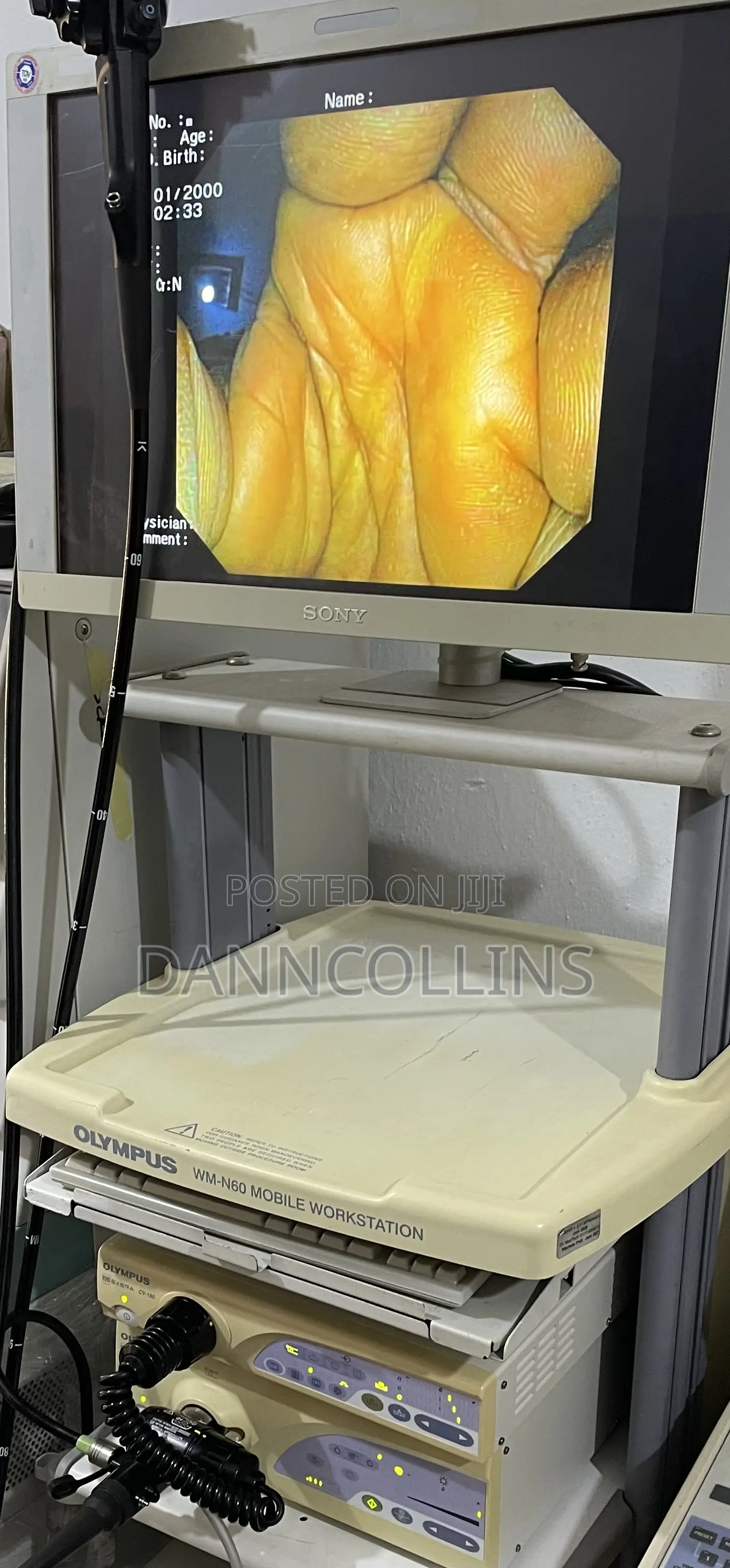 Olympus 160 Endoscope Tower