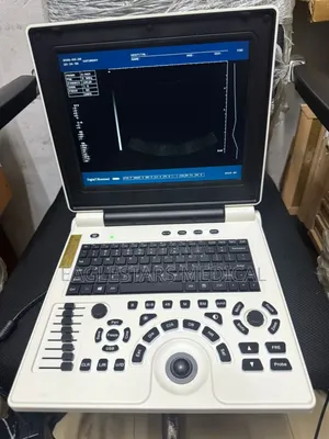 Laptop Ultrasound Scan