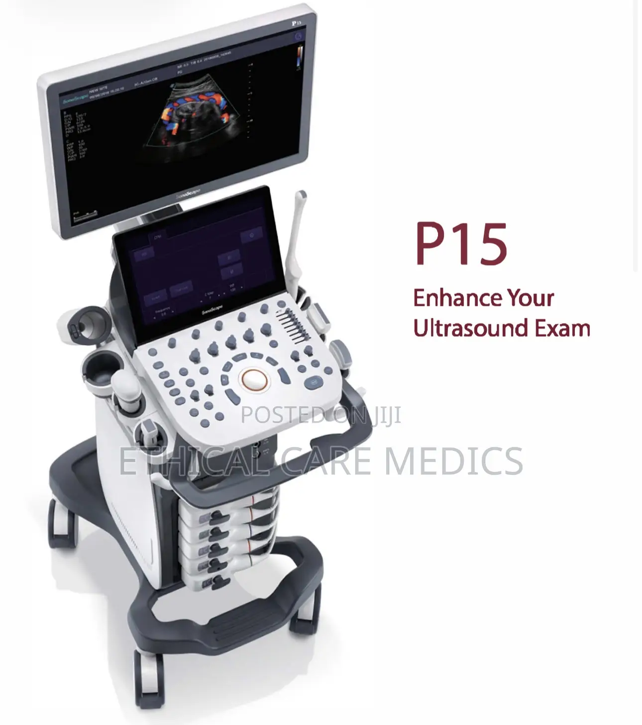 4d Ultrasound System